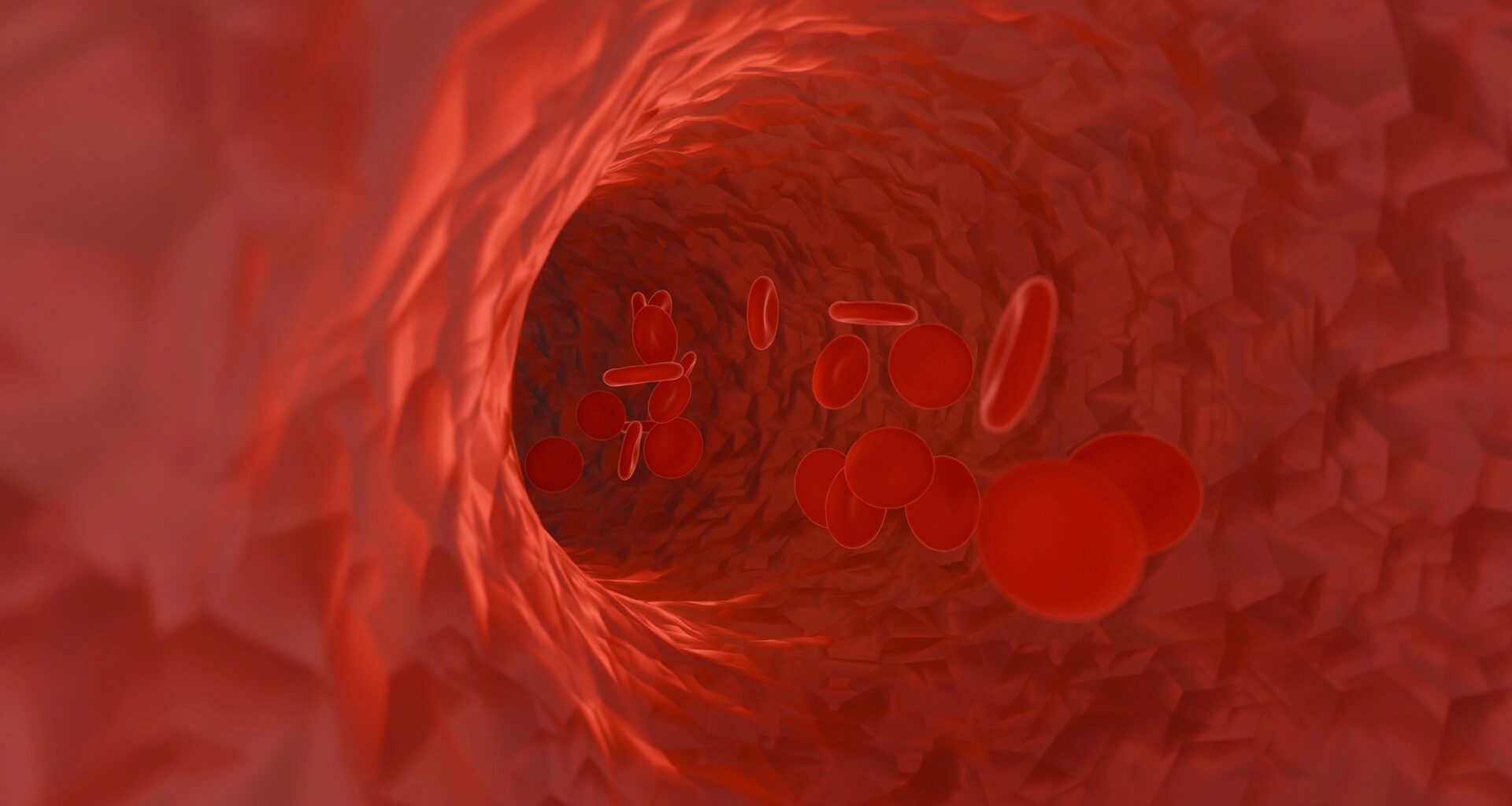 Långvarig diabetes ökar risken för kärlskador