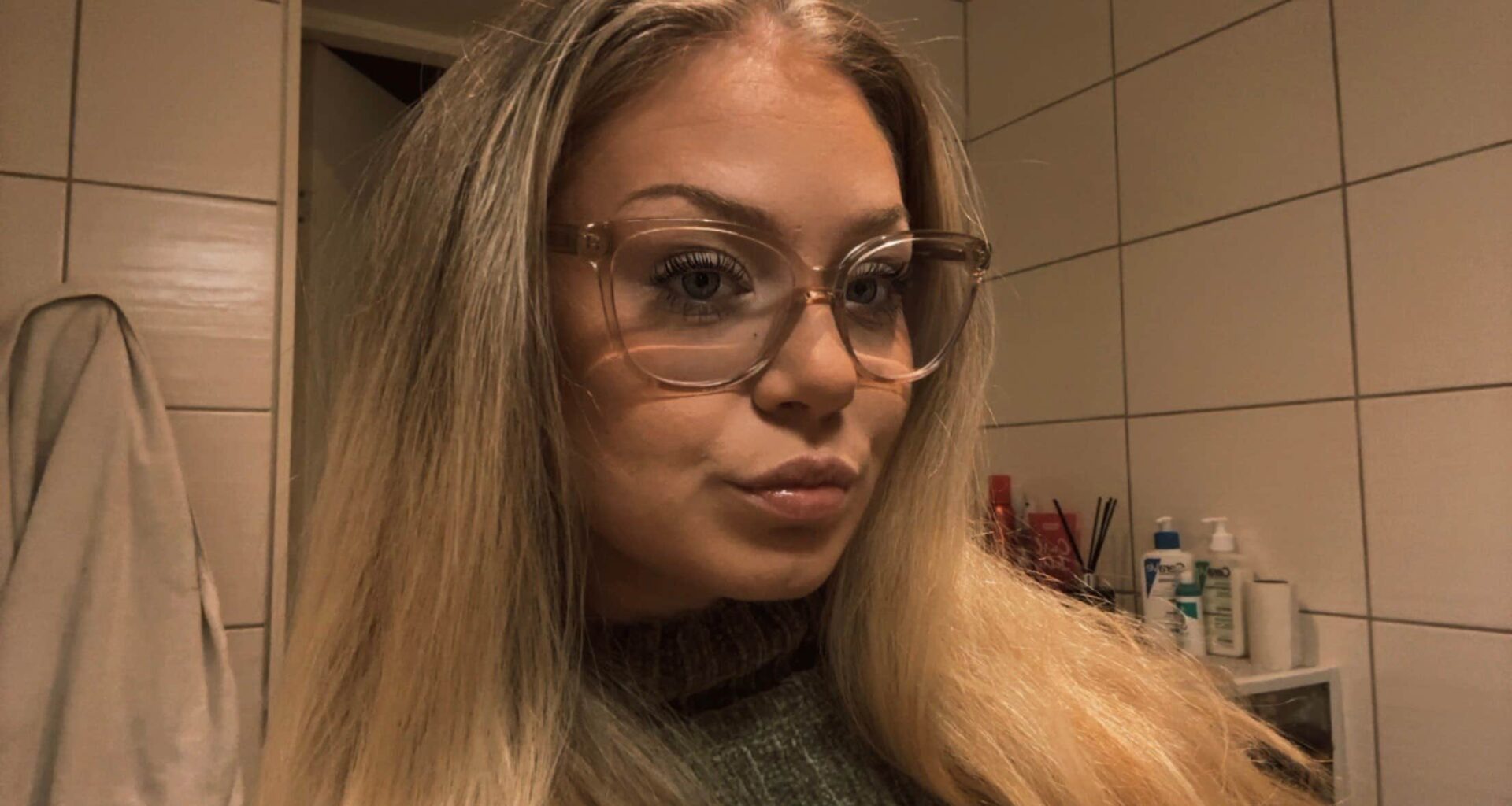Alicia, 23, får stora varbölder: ”Känner mig jätteful”