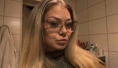 Alicia, 23, får stora varbölder: ”Känner mig jätteful”