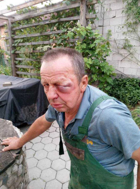 Antona Čemažarja so hudo ranili. FOTO: Facebook