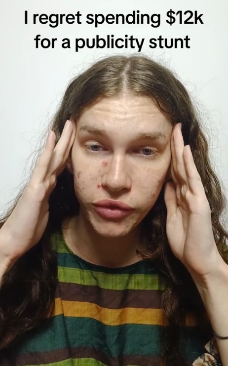 Woman regrets $12,000 cat-like cosmetic procedure publicity stunt.