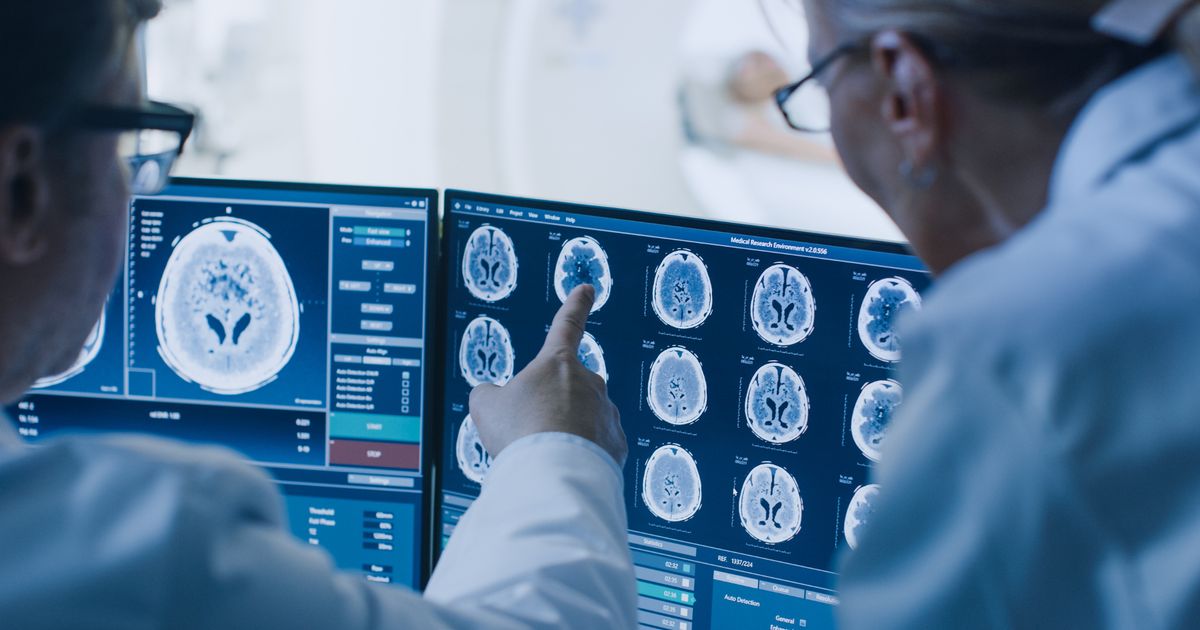 Experts say drug commonly taken by millions can increase dementia risk 33 per cent