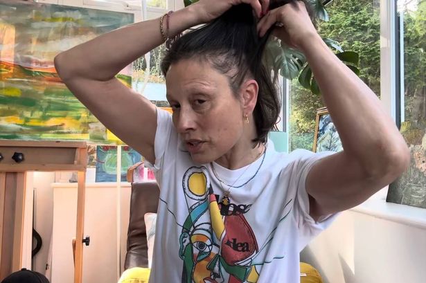 Melanie Sykes separating her hair to show her alopecia bald spots