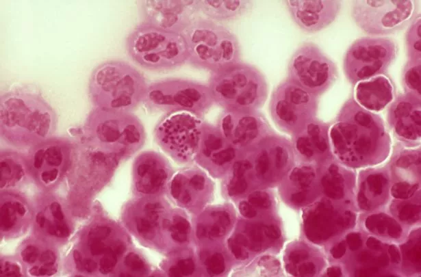 A gonorrhoea infection is caused by the bacteria Neisseria gonorrhoeae
