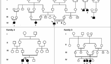 Report of a missense TJP2 variant associated to PFIC4 with a pronounced phenotypic variability: Focus on the structural effects on the protein level