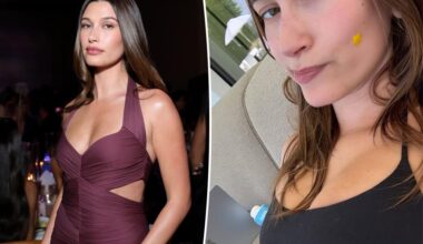 Hailey Bieber dealing with recurring health issue that previously left her 'nauseous'