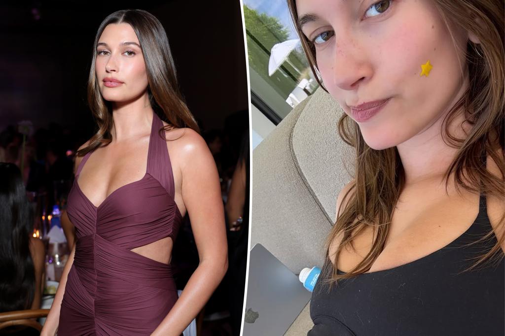 Hailey Bieber dealing with recurring health issue that previously left her 'nauseous'
