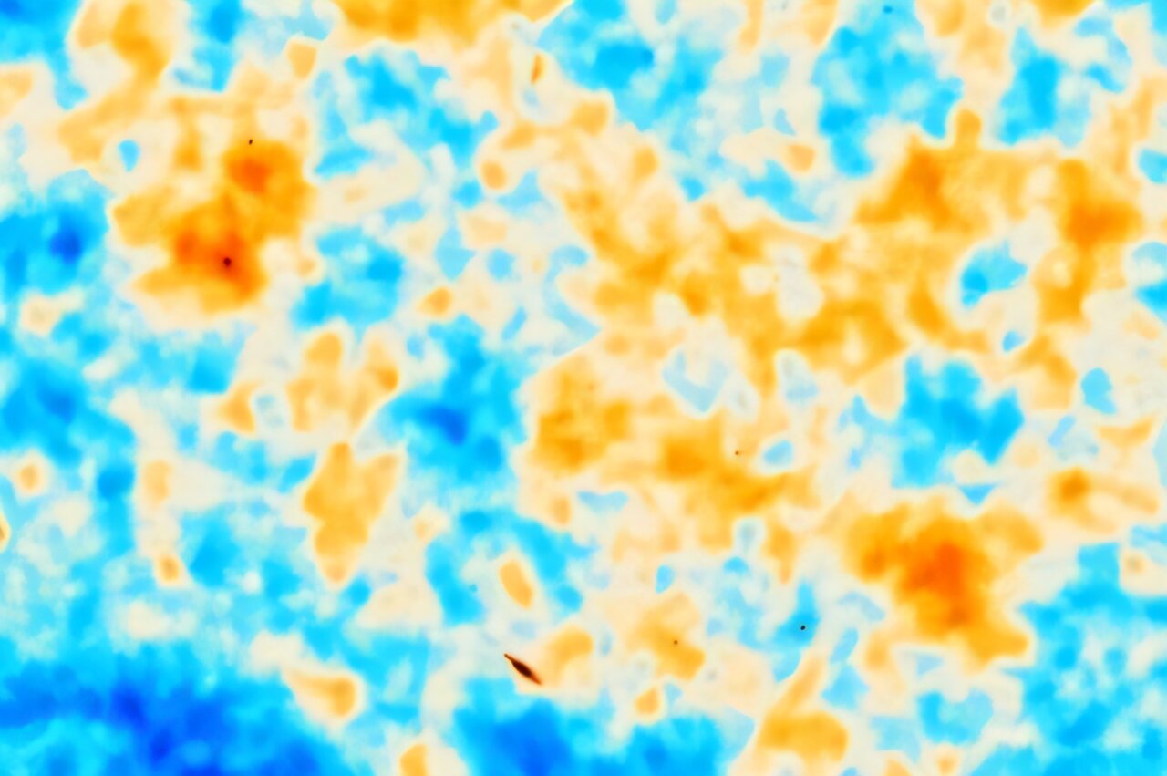 The significance of the recent 'baby pictures' showing the universe when it was just 380,000 years old