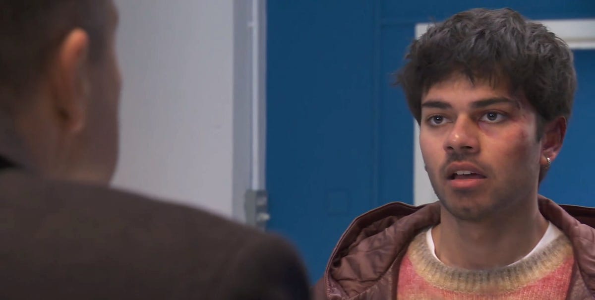 Hollyoaks' Dillon makes a huge mistake after brutal attack