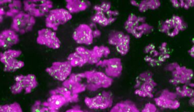 Cell biologists discover two proteins are key to proper transfer of genetic material