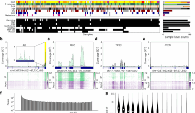 The landscape of N6-methyladenosine in localized primary prostate cancer