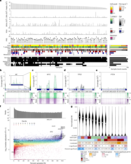 The landscape of N6-methyladenosine in localized primary prostate cancer