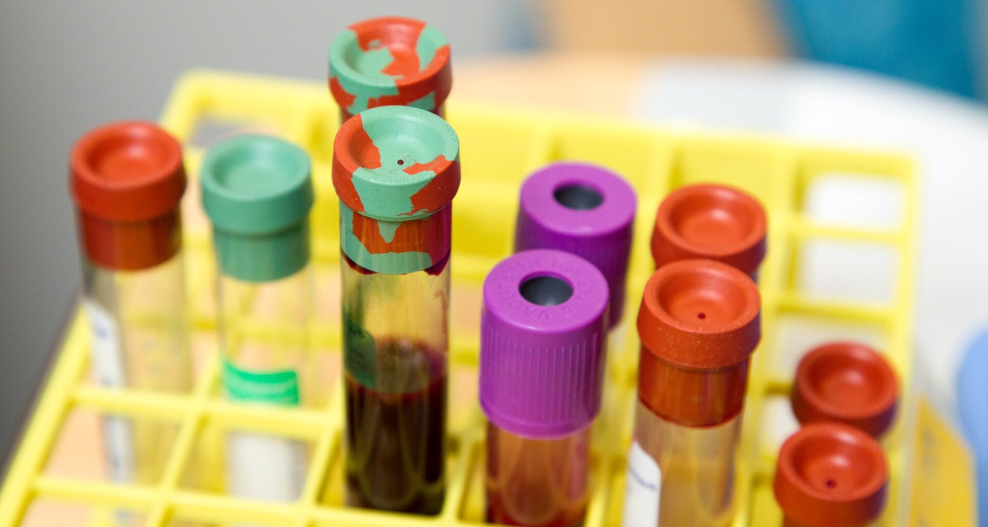 How do age, sex, hormones and genetics affect dementia biomarkers in the blood?