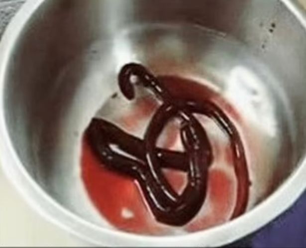 Worm