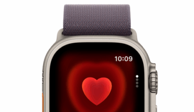 Apple Watch saves woman's life, lead to diagnosis of life-threatening leukemia
