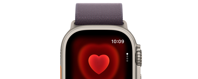 Apple Watch saves woman's life, lead to diagnosis of life-threatening leukemia