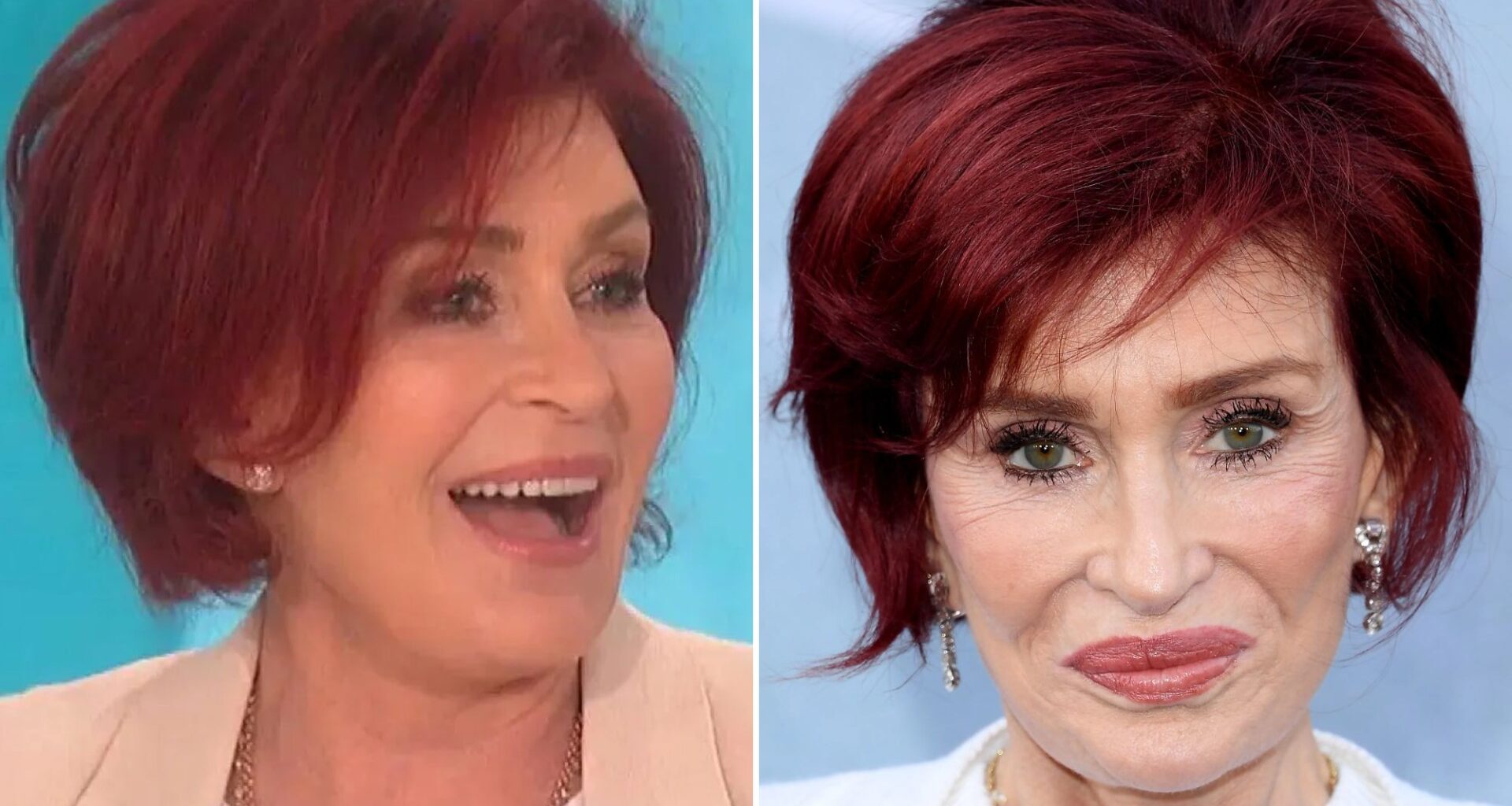 'Ozempic mouth' is latest side effect of fat jabs that can strike in WEEKS - but which stars are paying the price?