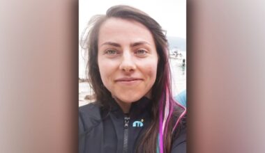 Woman, 34, left with horror health conditions after contracting Covid
