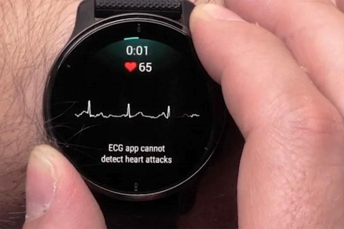 Garmin Fenix And Venu 3 Owners Get A New Health Feature