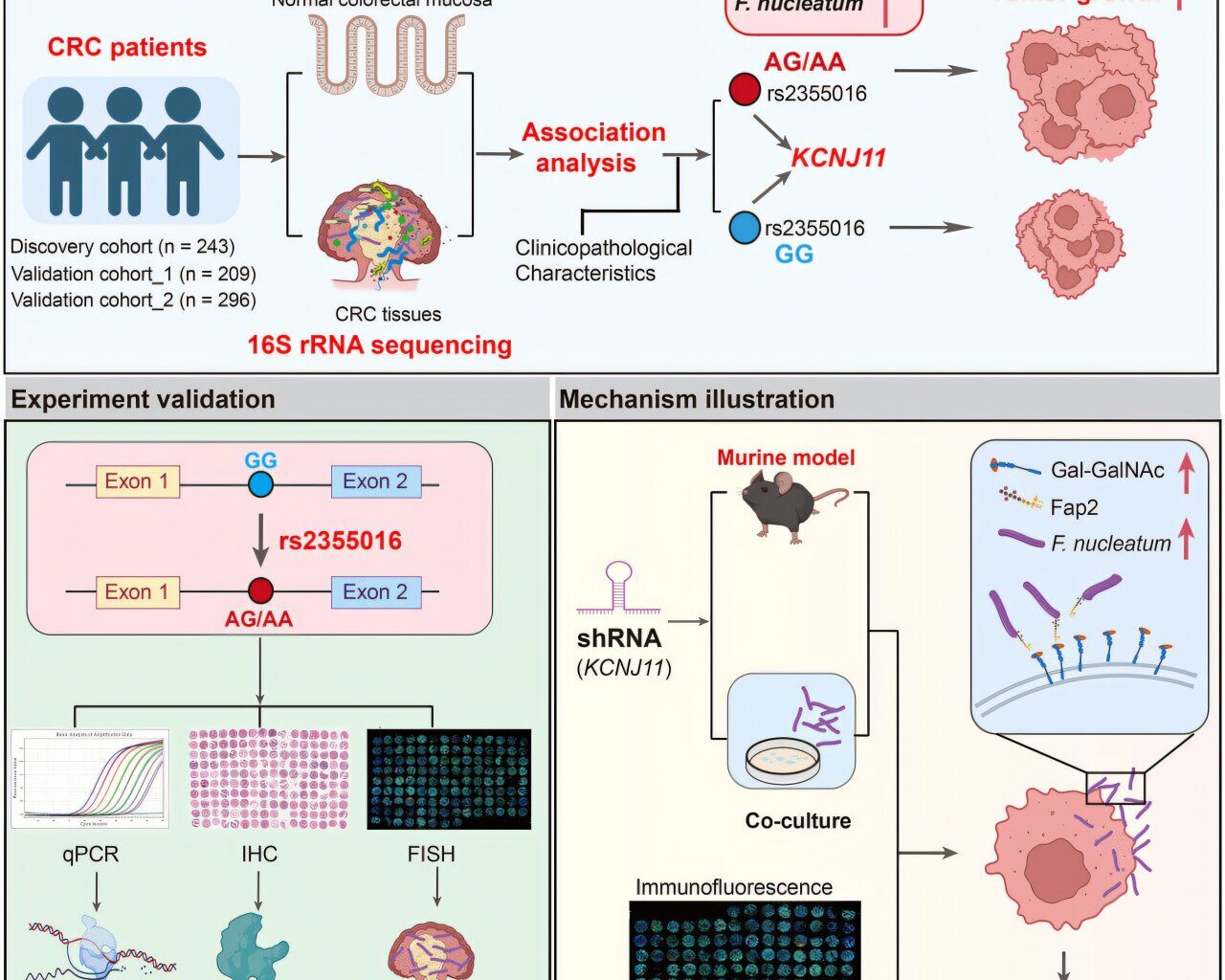 How human genetics and intratumoral microbiota affect colorectal cancer