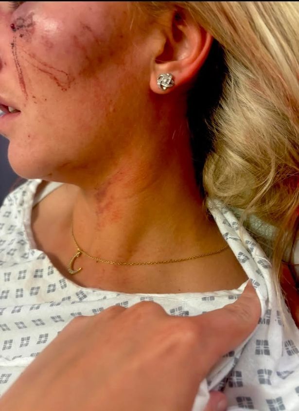 Nicole's face was covered in blood