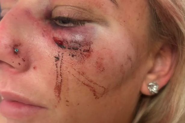 Nicole was beaten at the hands of Jordan McMahon