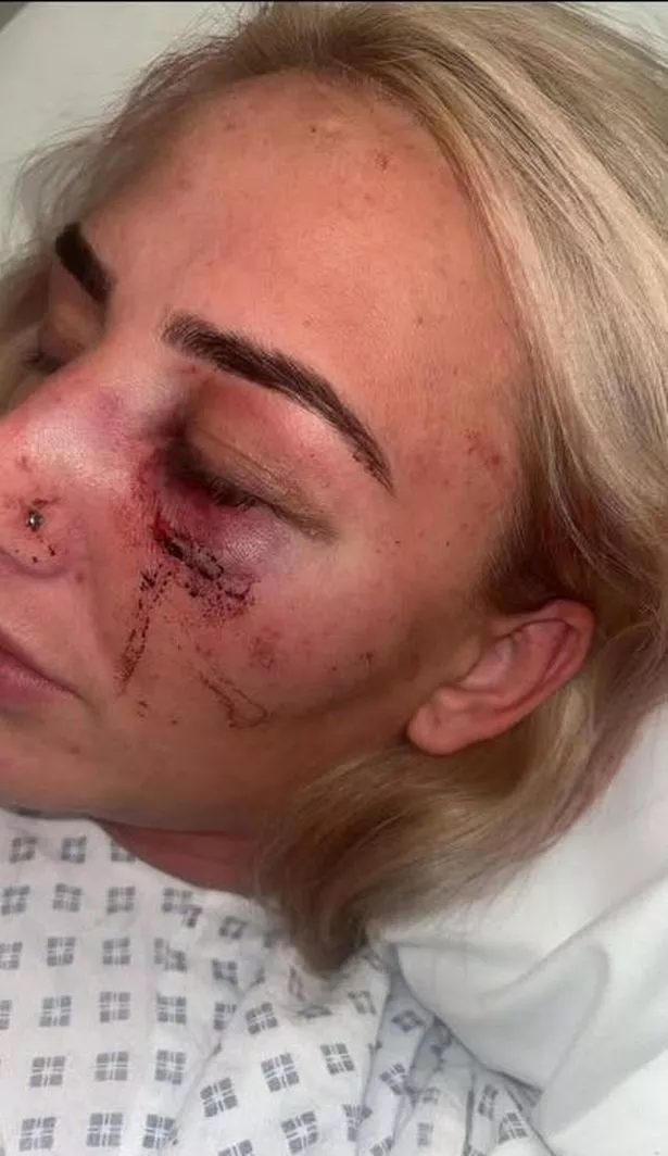 Pictures taken of Nicole's injuries