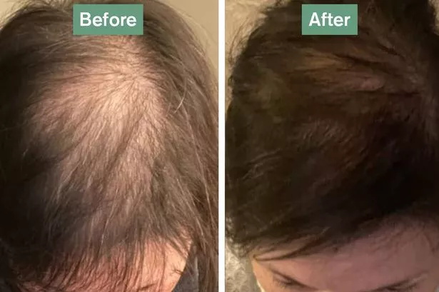 Dr Vegan Hair Saviour® before and after