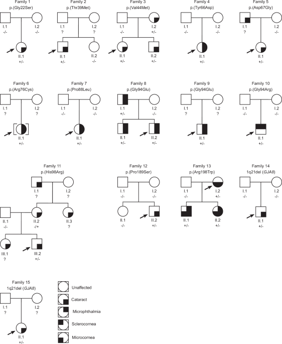 GJA8-associated developmental eye disorders: a new multicentre study highlights mutational hotspots and genotype-phenotype correlations