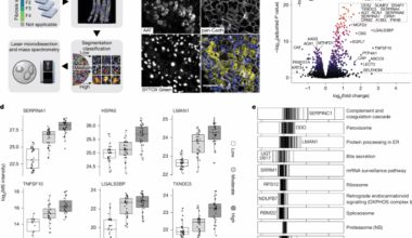 Deep Visual Proteomics maps proteotoxicity in a genetic liver disease