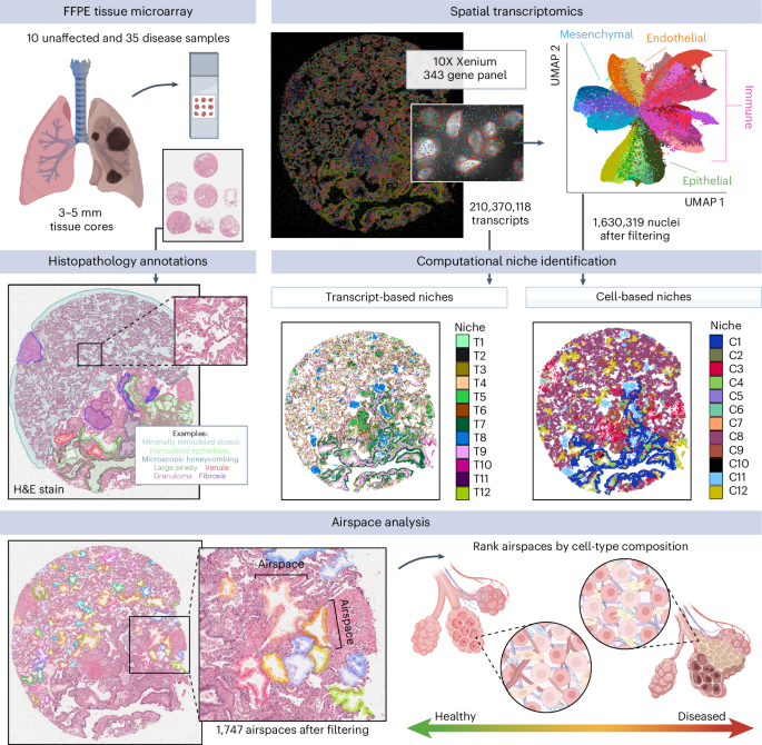 Spatial transcriptomics identifies molecular niche dysregulation associated with distal lung remodeling in pulmonary fibrosis