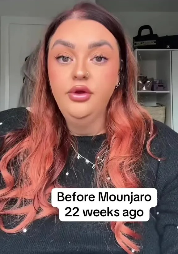Woman before Mounjaro treatment.