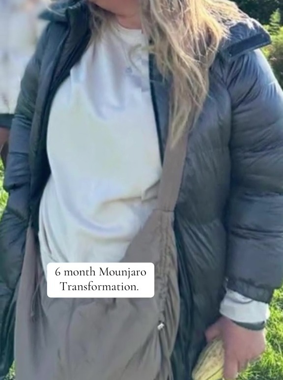 Six-month Mounjaro weight loss transformation.