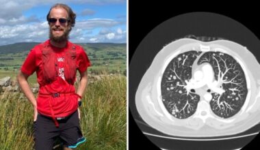 Terminally ill teacher with over 50 tumours to run London Marathon | UK | News