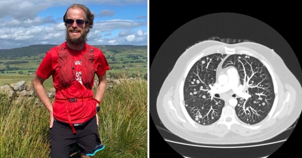 Terminally ill teacher with over 50 tumours to run London Marathon | UK | News