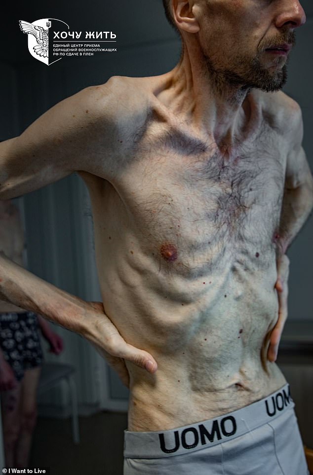 Roman, one of 74 prisoners returned to Ukraine in May. Despite allegedly having no involvement in the fighting, Roman was 'taken hostage' by Russian forces in March 2022