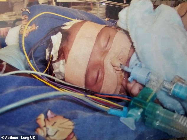 Despite making a miraculous recovery as a baby, Spike's life was forever altered by the bacterial infection, medically called pertussis