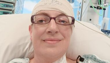 Charlie Rolstone has suffered a series of strange symptoms since childhood, but only got a diagnosis of chiari malformation at the age of 41.