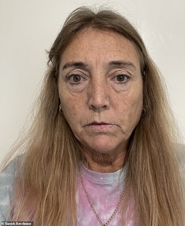 Her only hope lies in going to the USA so she can undergo an operation to wrap her spine in a bid to stop more CSF leaks as well as repair the broken shunts in her head