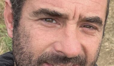 Brian Smith, 43, was forced to go to hospital after suffering a suspected false widow spider bite