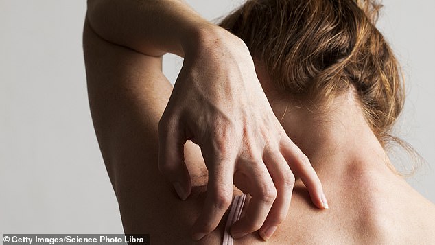 Treating eczema is hard work, and many patients fail to take the proper steps