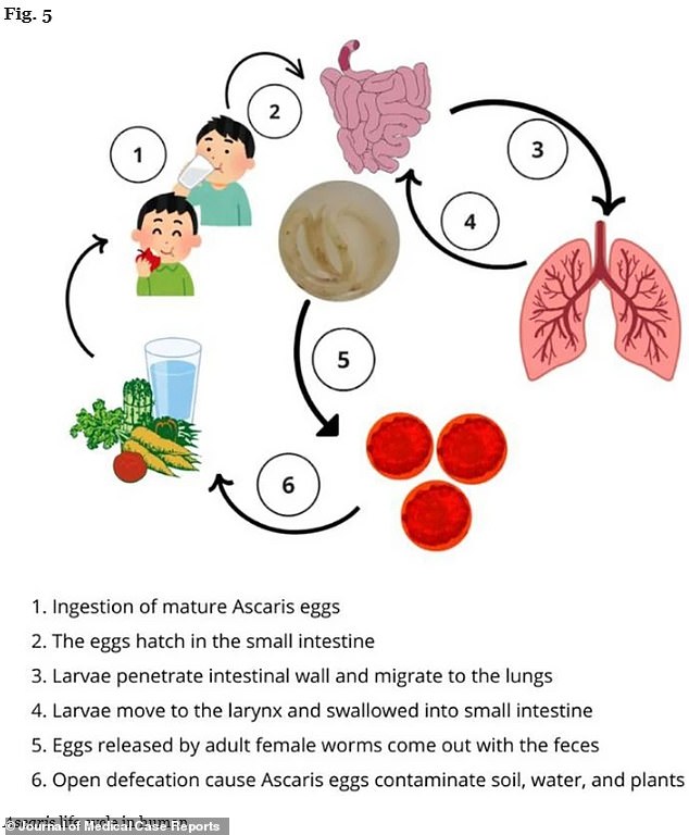 People unwittingly become infected by ascaris lumbricoides by consuming contaminated food or water laced with the worm's microscopic eggs