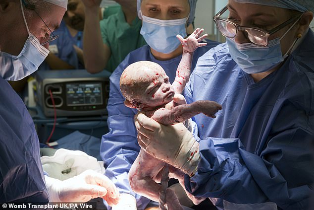 But the surgeons responsible for a landmark womb transplant have ruled out conducting the same procedure for trans patients (Pictured: The birth of baby Amy)