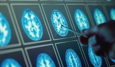 Covid, a virus that has infected about two thirds of Britons, could increase the risk of developing dementia scientists warn