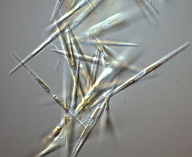 Domoic acid toxicosis stems from an organism called Pseudo-nitzschia (pictured), which can grow into algal blooms in the water. The blooms produce the domoic acid, which infects marine life swimming through it