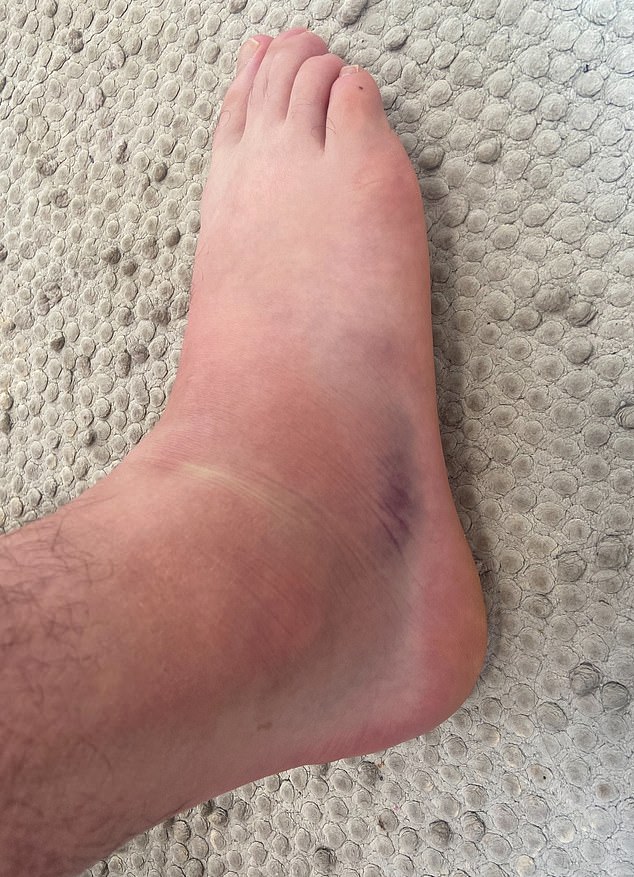 After chasing after the thief, I ended up £700 worse off and in hospital with a badly sprained ankle