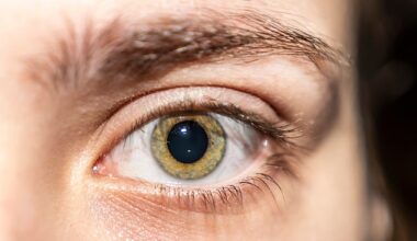 The the obscure clue in your eye that could reveal you will get dementia as young as 45-years-old  all comes down to your blood vessel health and the thickness of your retina, researches from New Zealand have said