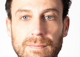 Brad Baker, before hair system