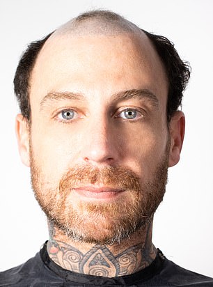 Brad Baker, before hair system
