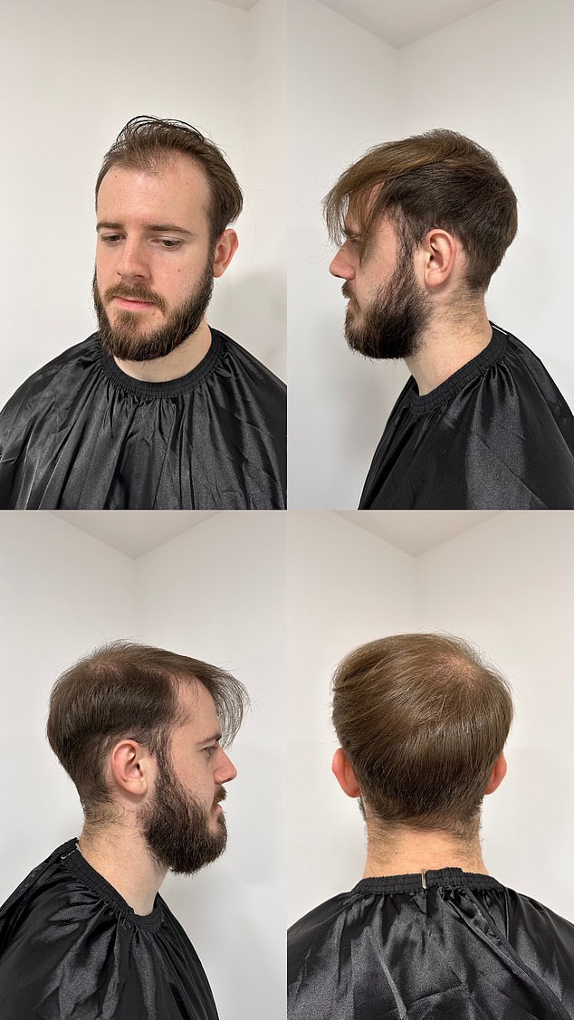 Casting shoot for B-Spoke Hair Systems, before hair system.